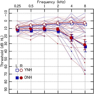 Age-Related Changes in Interaural-Level-Difference-Based Across-Frequency Binaural Interference